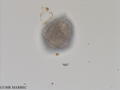 phyto/Bizerte/bizerte_bay/RISCO November 2015/Protoceratium sp4 (Baie_T5-C2-Protoceratium sp2-11).tif(copy)_thumb.jpg
